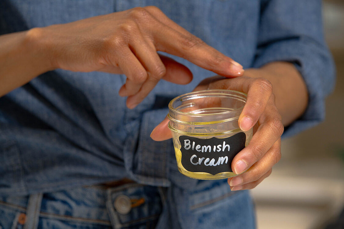 A person has an open jar of homemade blemish cream which they are rubbing on their hand.